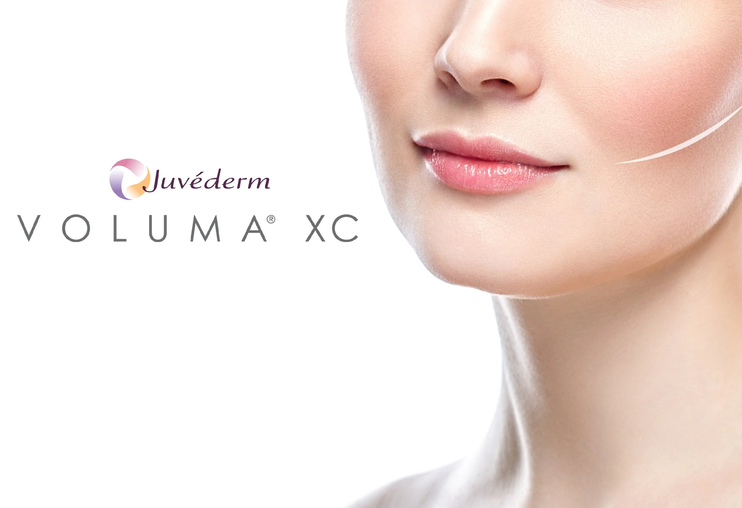 Close-up of a woman's face, focusing on her lips and cheek, next to the text 'Juvéderm VOLUMA XC' on a white background.