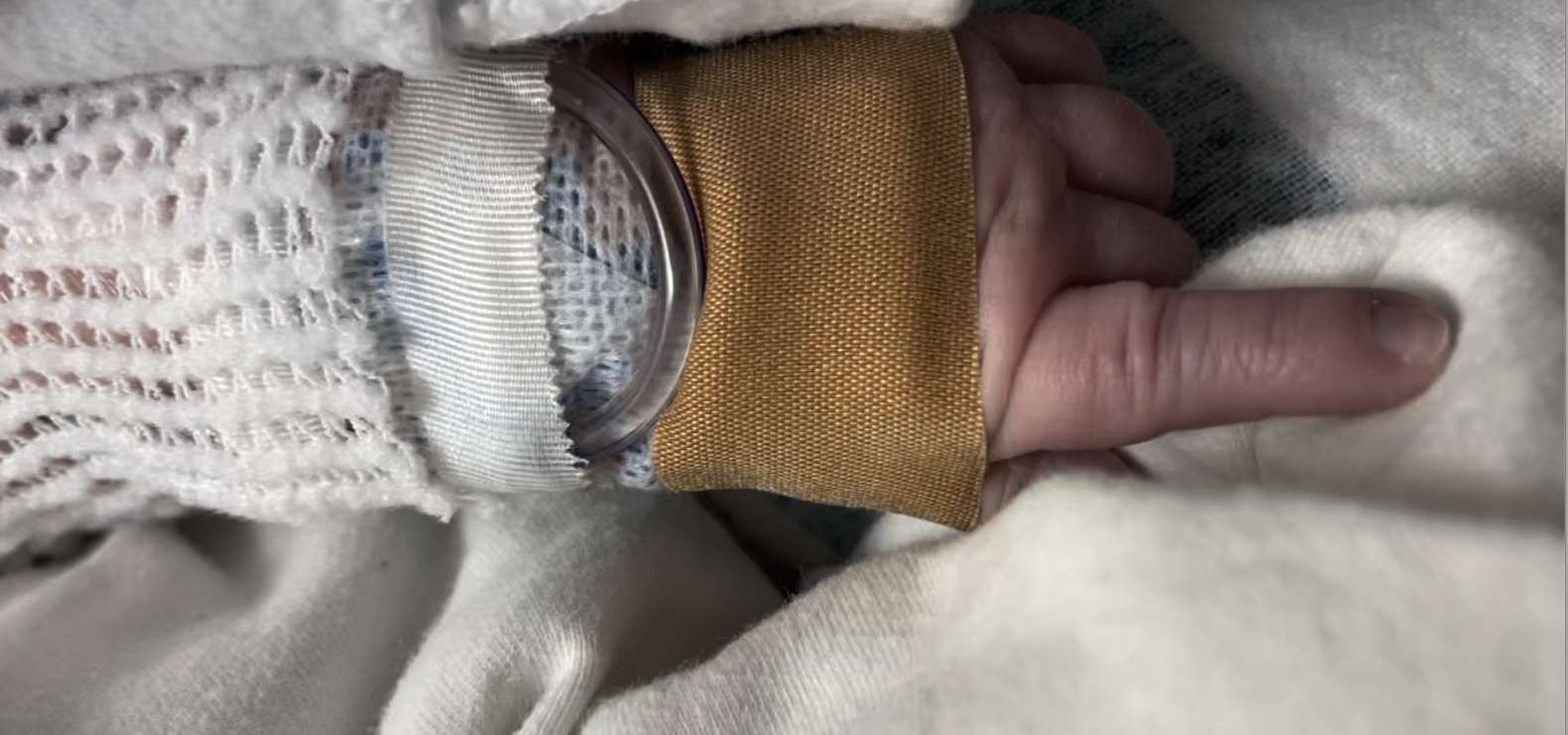 Young daughter’s hand holding a parent’s finger while receiving care in a hospital.