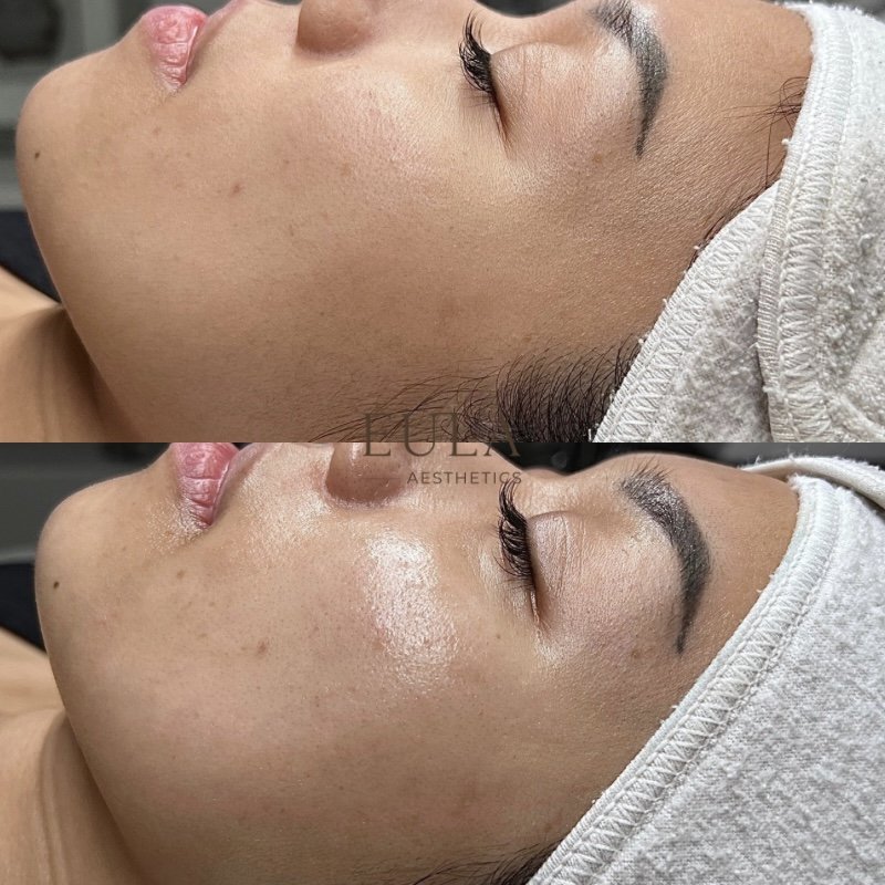 A woman receiving a facial treatment at a spa, lying down with a white headband, eyes closed, and her face relaxed.