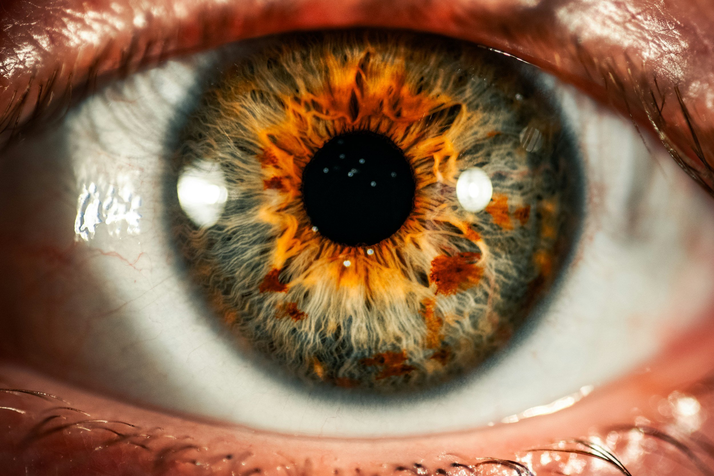 Consultation for a Brainspotting intensive to address trauma, anxiety, ADHD, and nervous system dysregulation