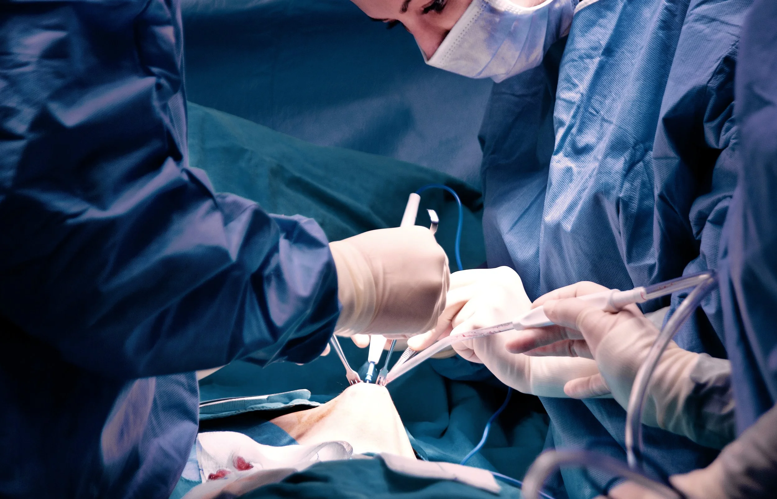 Ärzte bei einer Operation in einem Operationssaal, tragen Schutzkleidung und maskieren.