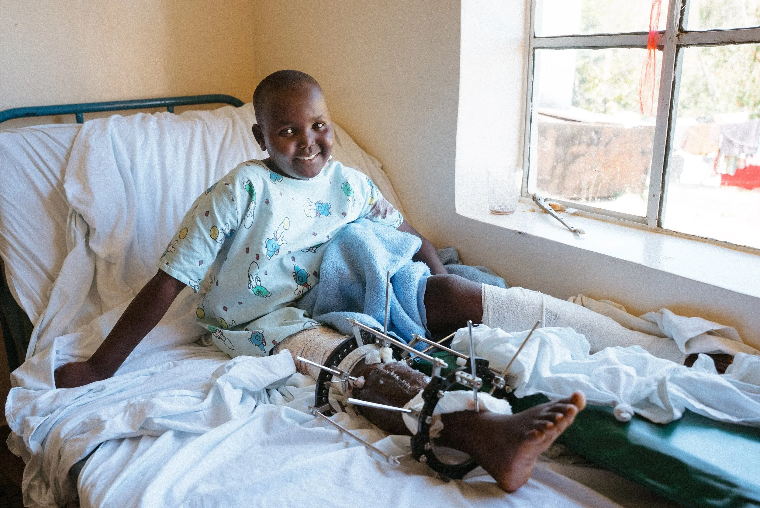 How a Simple Leg Injury Nearly Took Ryan’s Leg