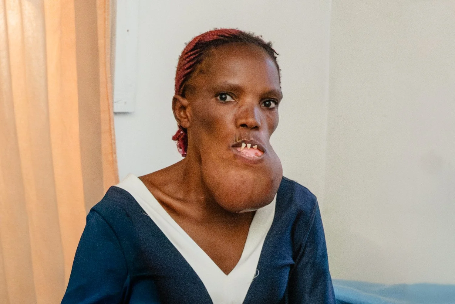 From Hiding Her Face to Smiling Again