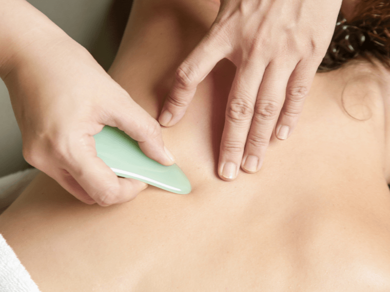 Gua sha treatment at Whitepine Wellness Acupuncture in Moncton, NB