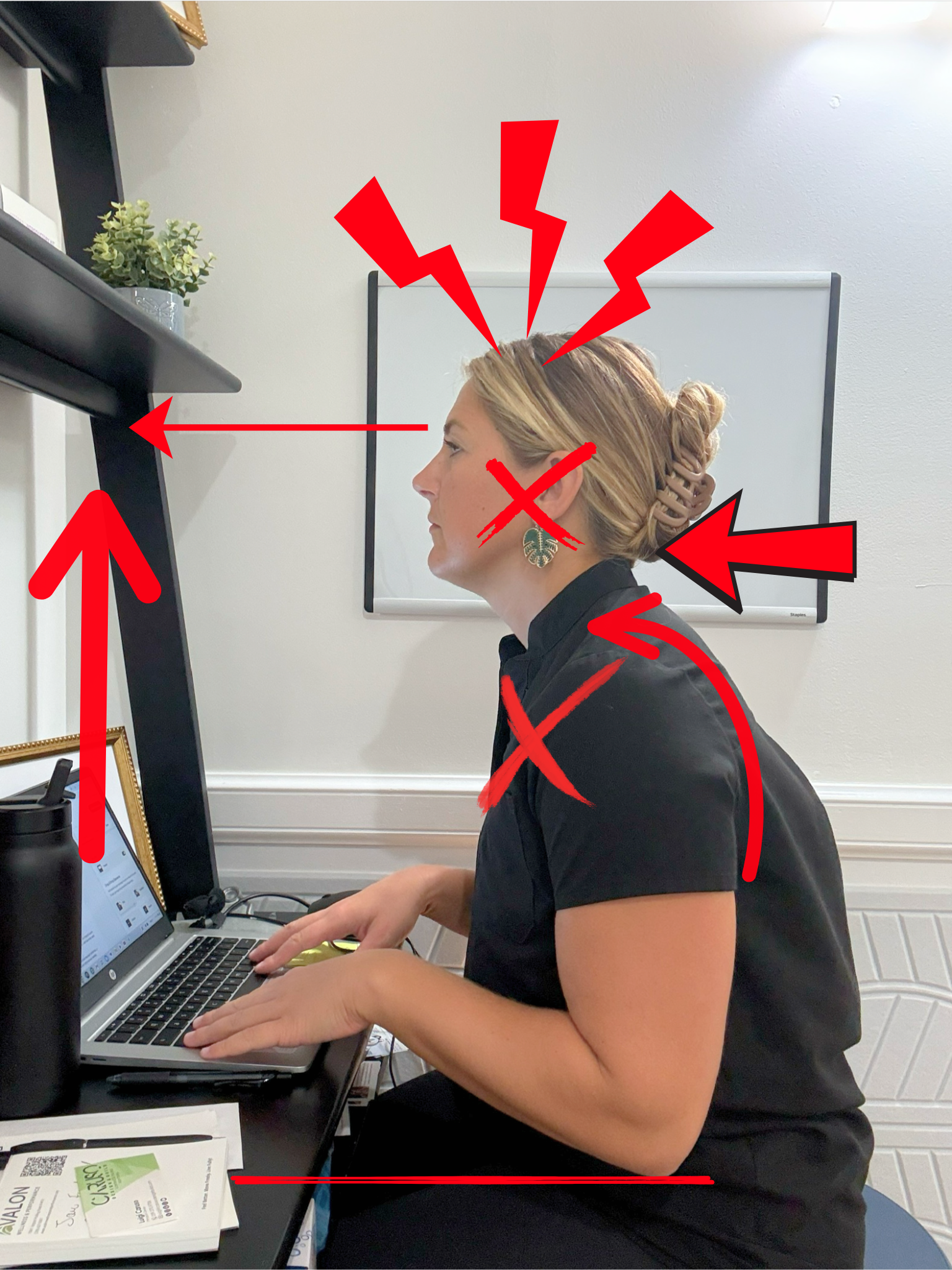 What Does Your Posture Have to Do With Your Jaw Pain?