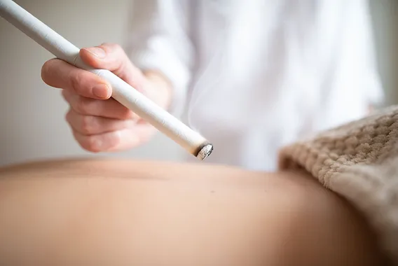 Moxibustion