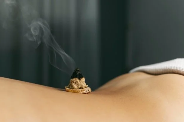 Cône de moxa en combustion sur le dos d'une personne.