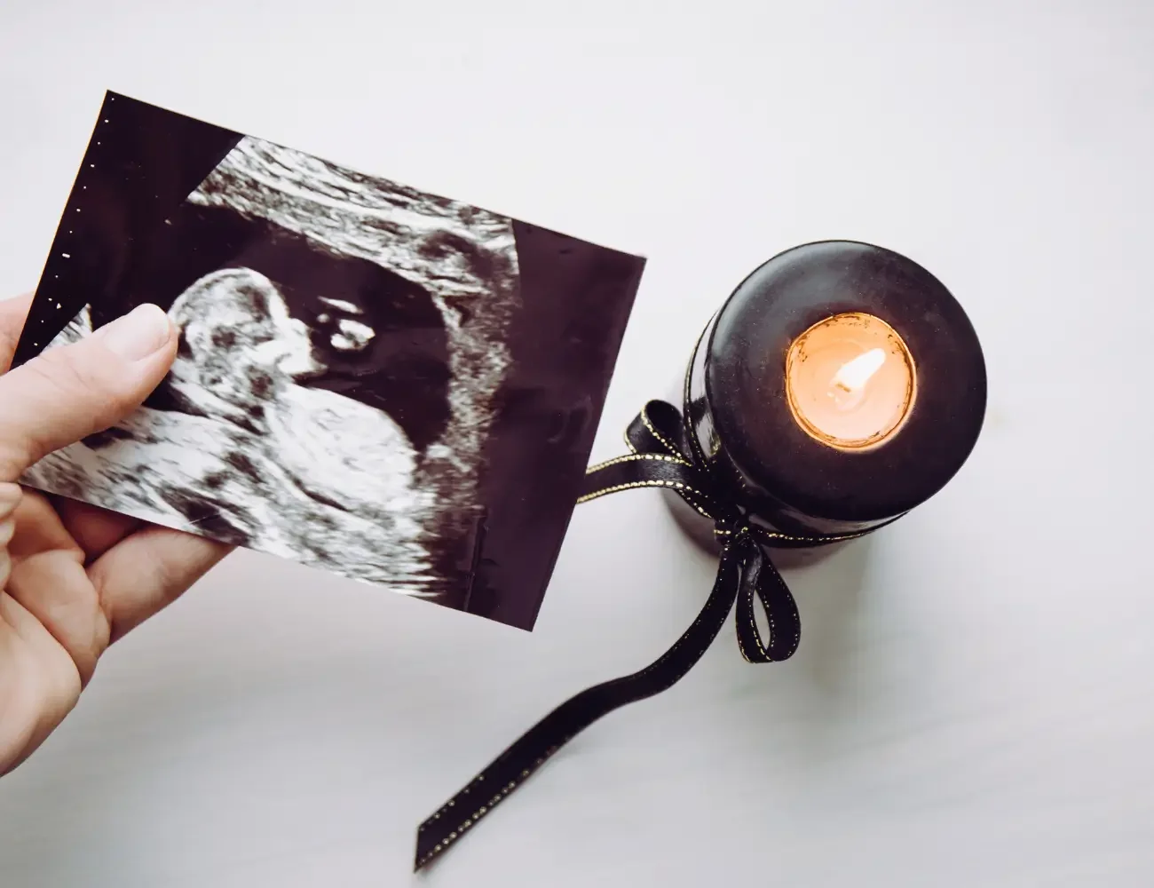 How Pregnancy Loss Therapy Can Help When Everyone Else Has Moved On