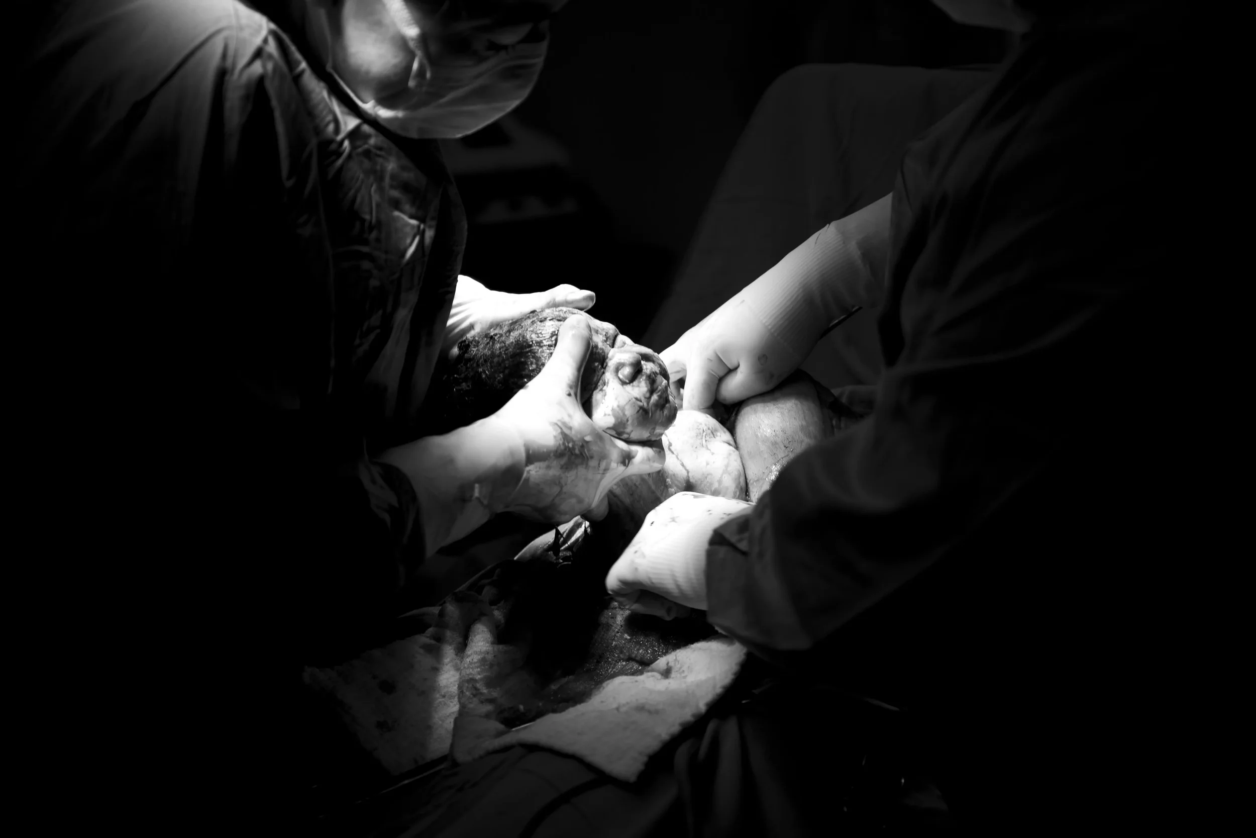 Is My Birth Trauma Real If Nothing Went Medically Wrong?