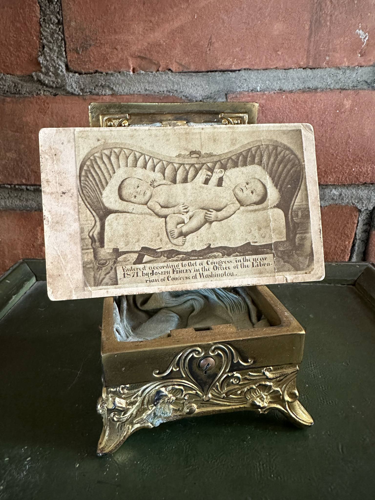 CDV of Conjoined Twins