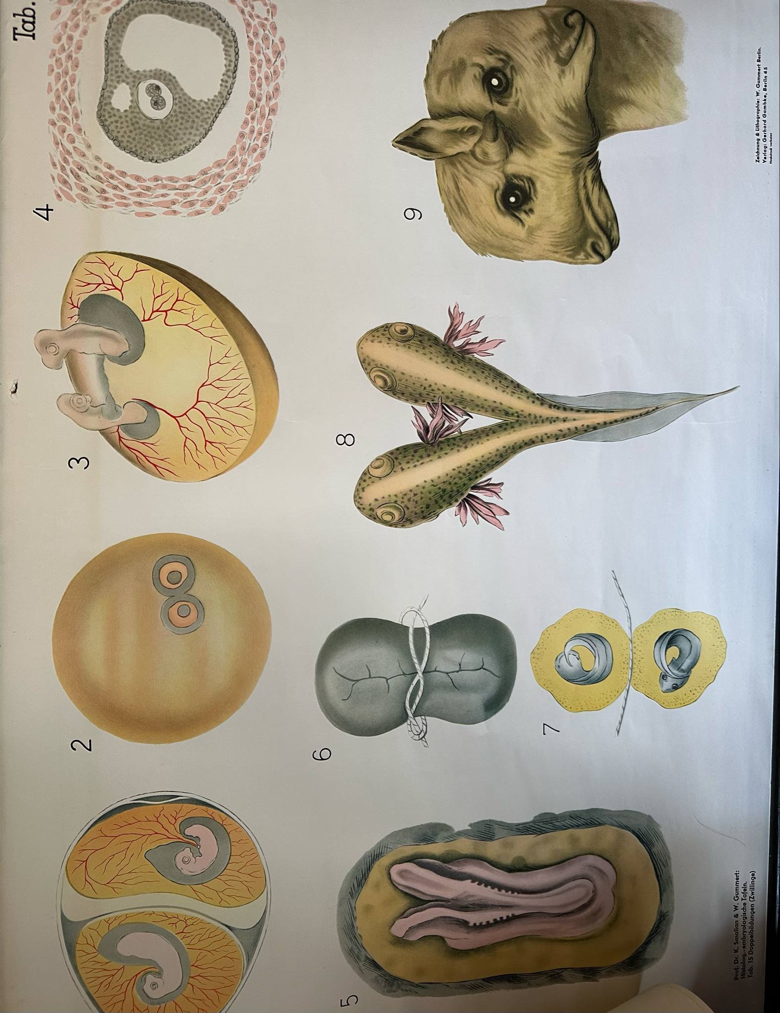 Conjoined Embryo Poster