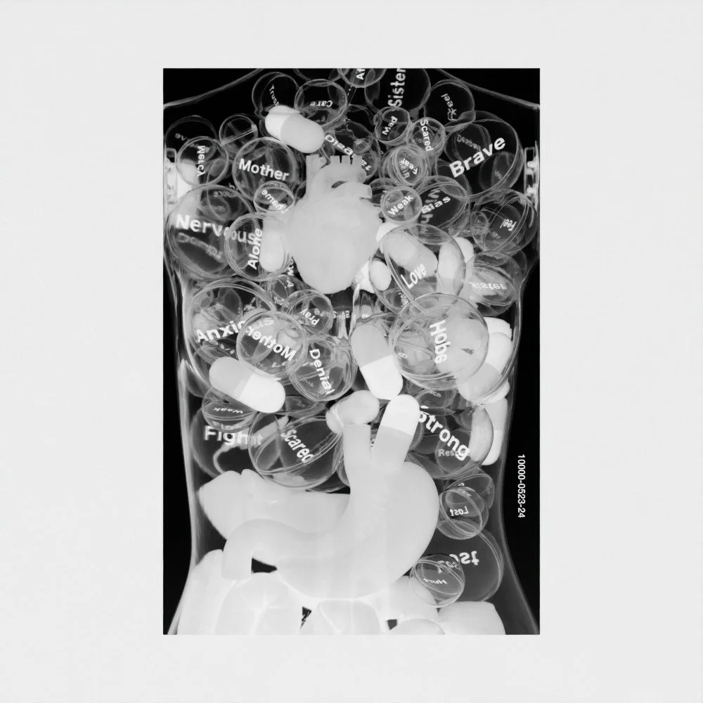 x-ray-print-chest.jpg