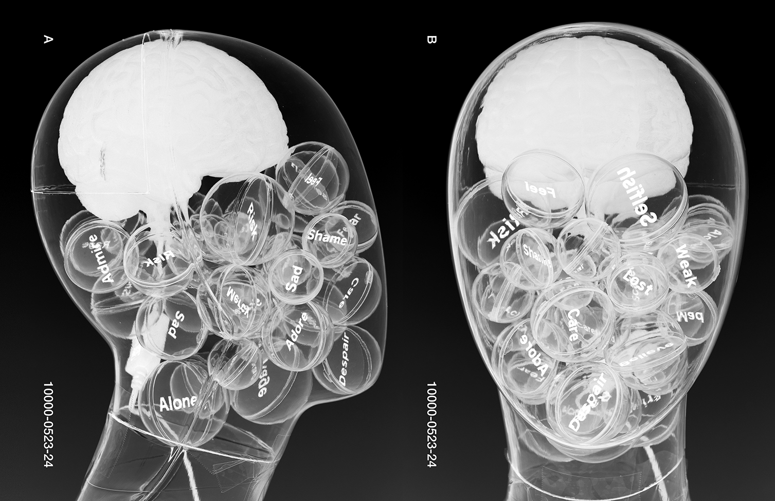 XRay-Landscape.png