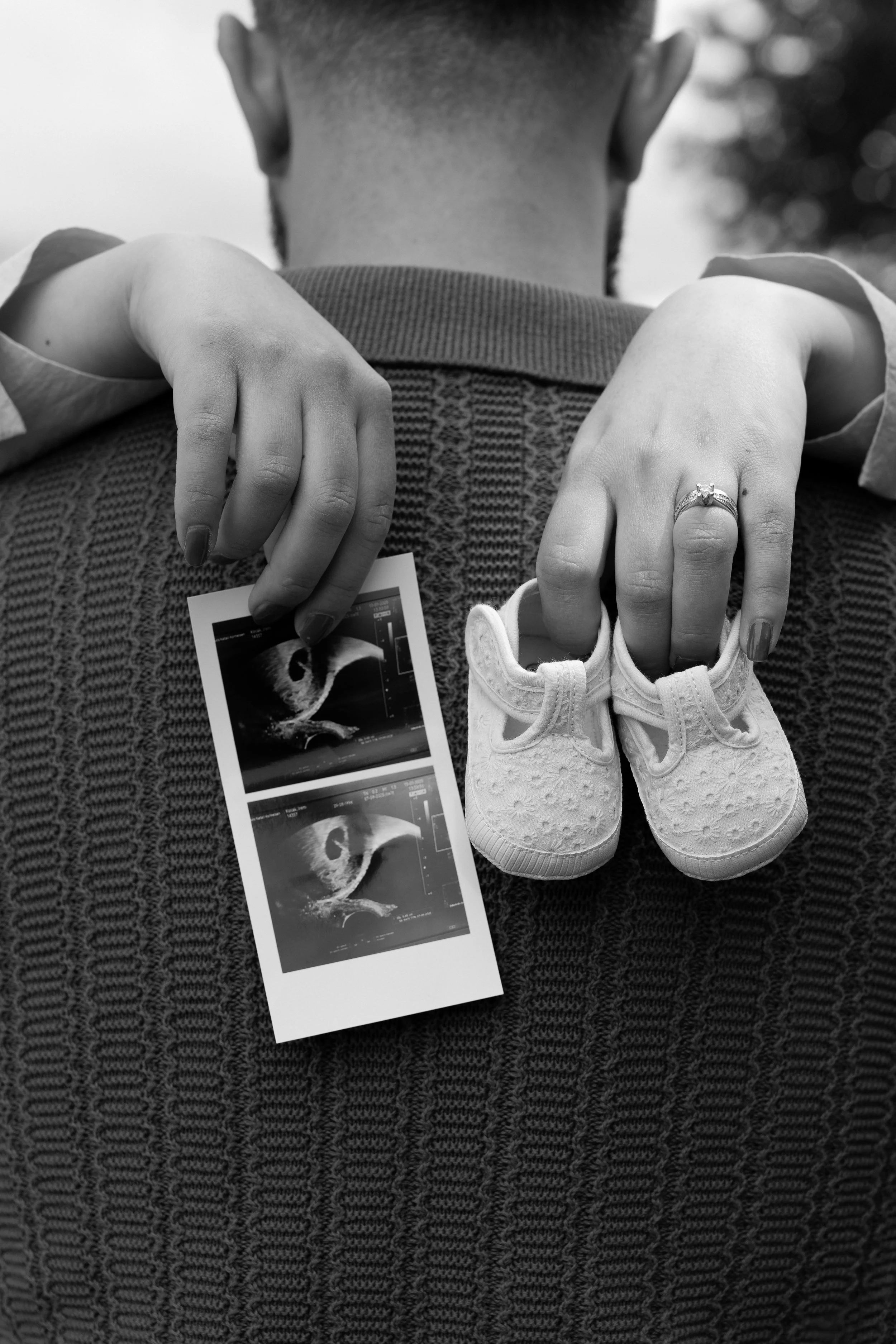 Schwangere Person hält Ultraschallbilder und ein Paar Baby-Schuhe, Nahaufnahme in Schwarz-Weiß.