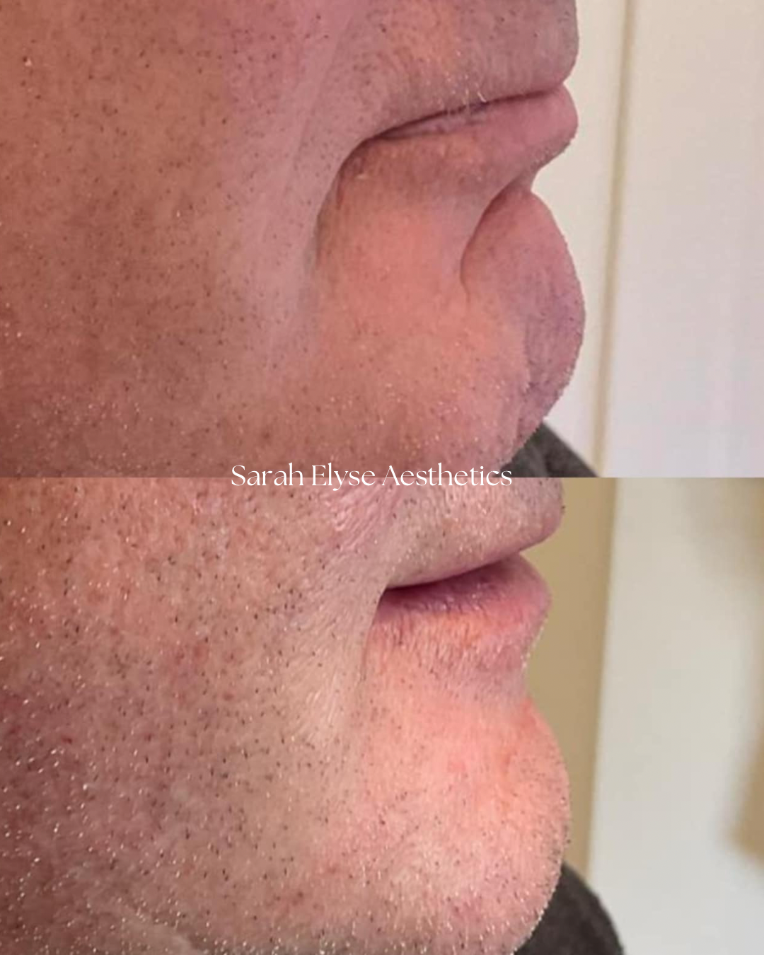 Sarah Elyse Aesthetics.PNG