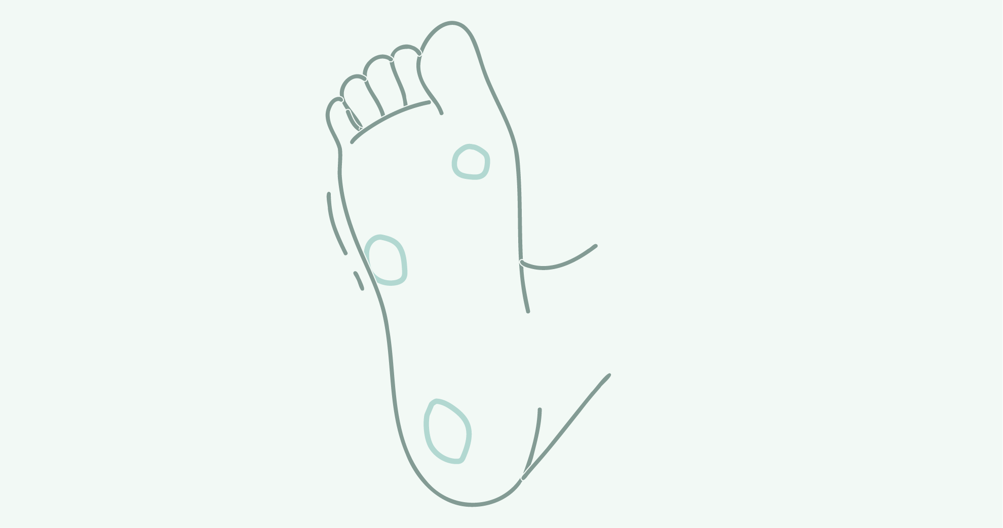 A simple outline drawing of a person’s foot and ankle with a focus on a bunion, depicted in blue lines on a light background.