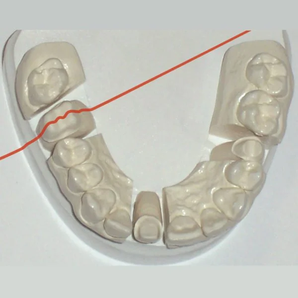 IVORY OPTIC SCANNING STONE 25LB