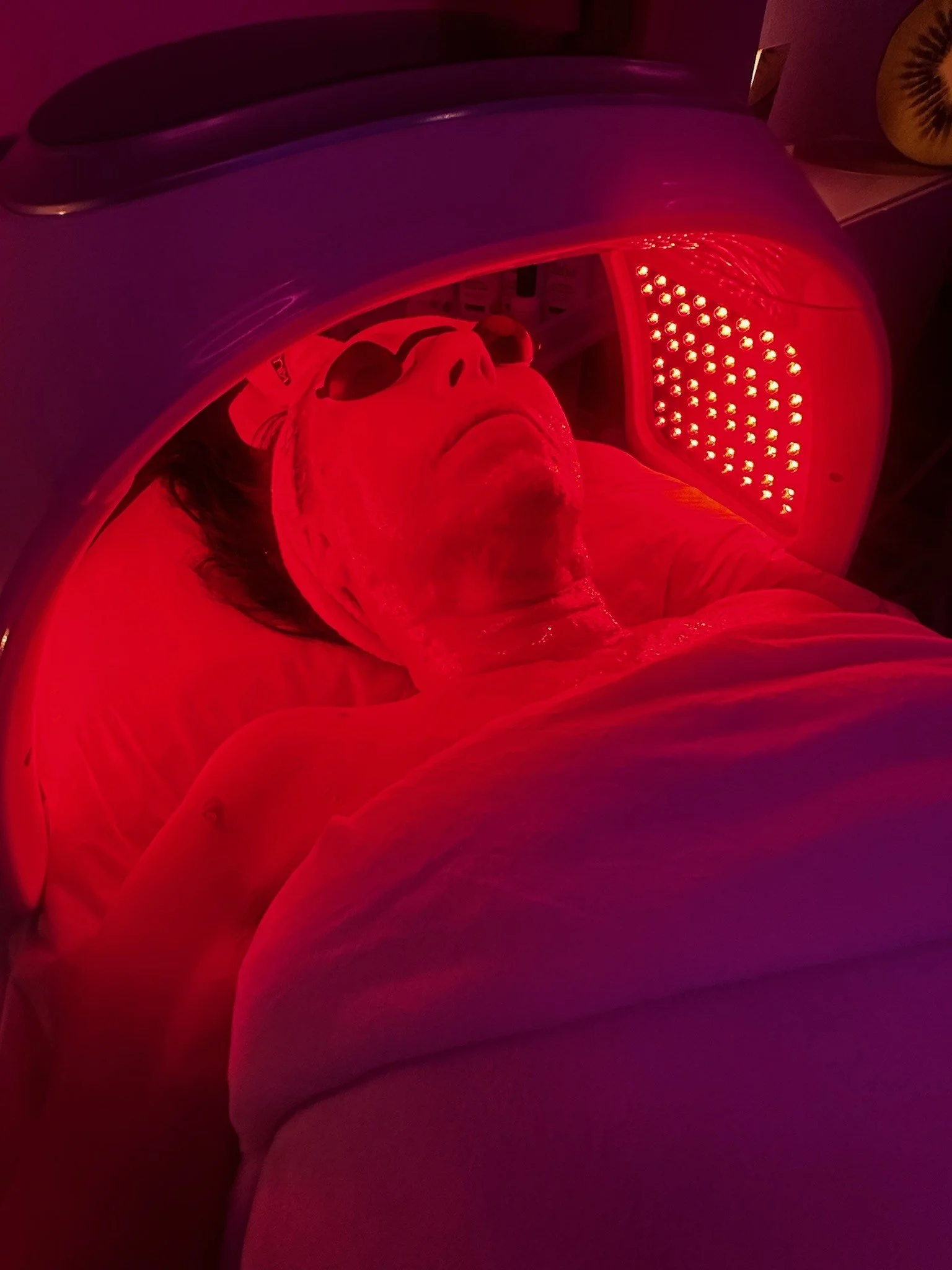 LED Light therapy San Diego