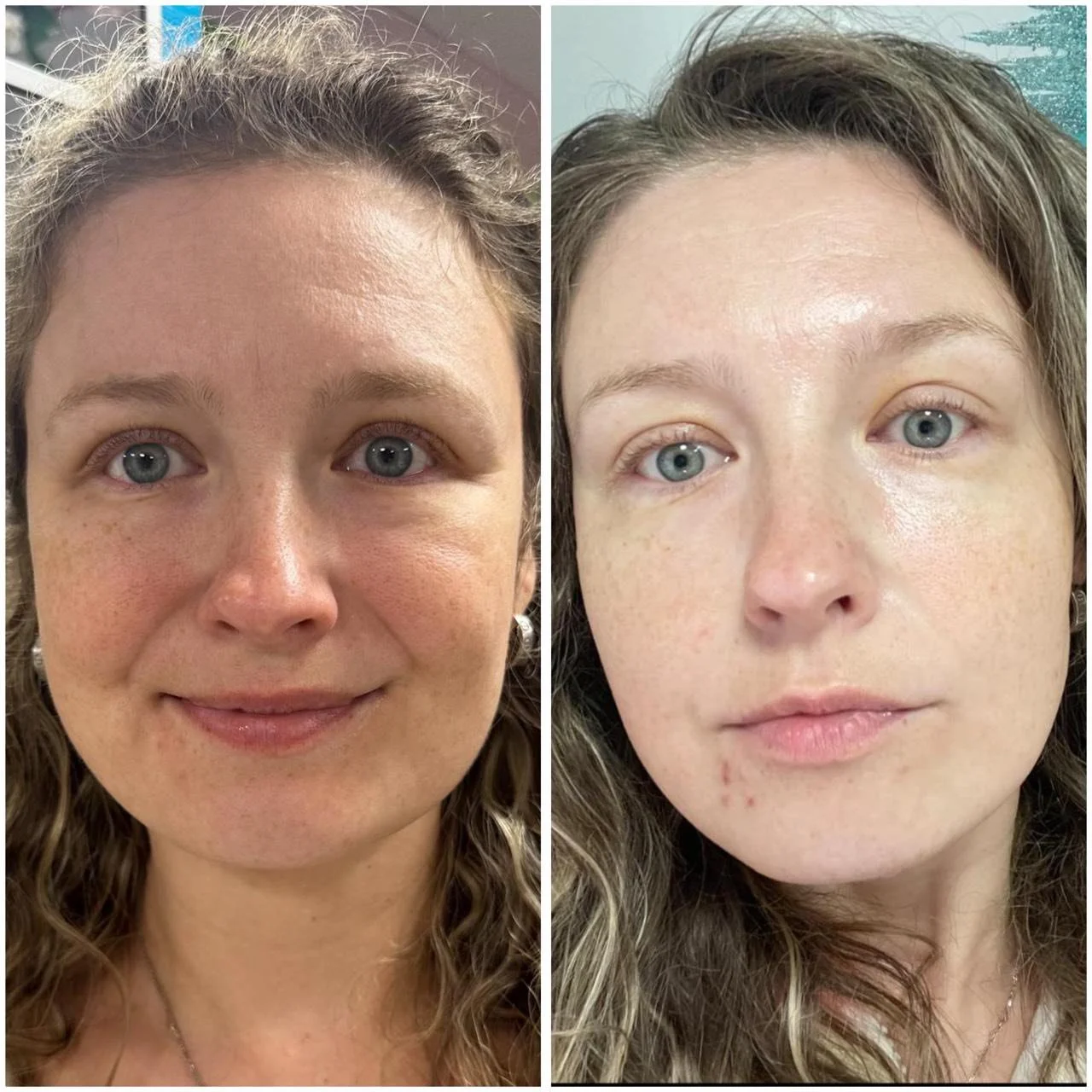 Is an Organic Facial Good for Your Skin?
