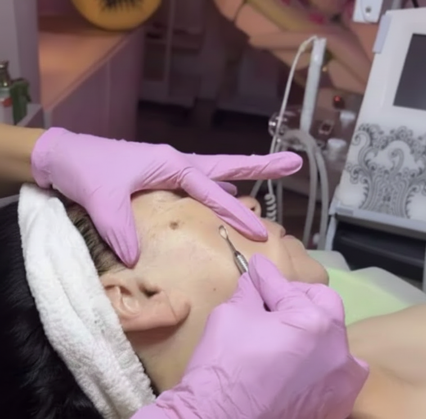 Do Extractions Hurt? How Facials Clean Your Pores and Transform Your Skin