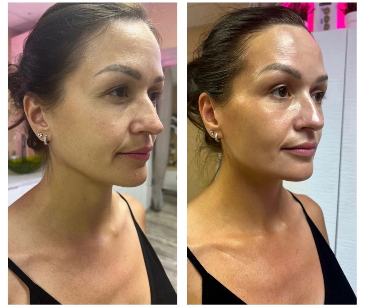 Is a Sensitive Skin Facial Right for You? Here’s How Kiwi Spa Helps Calm and Strengthen Your Skin