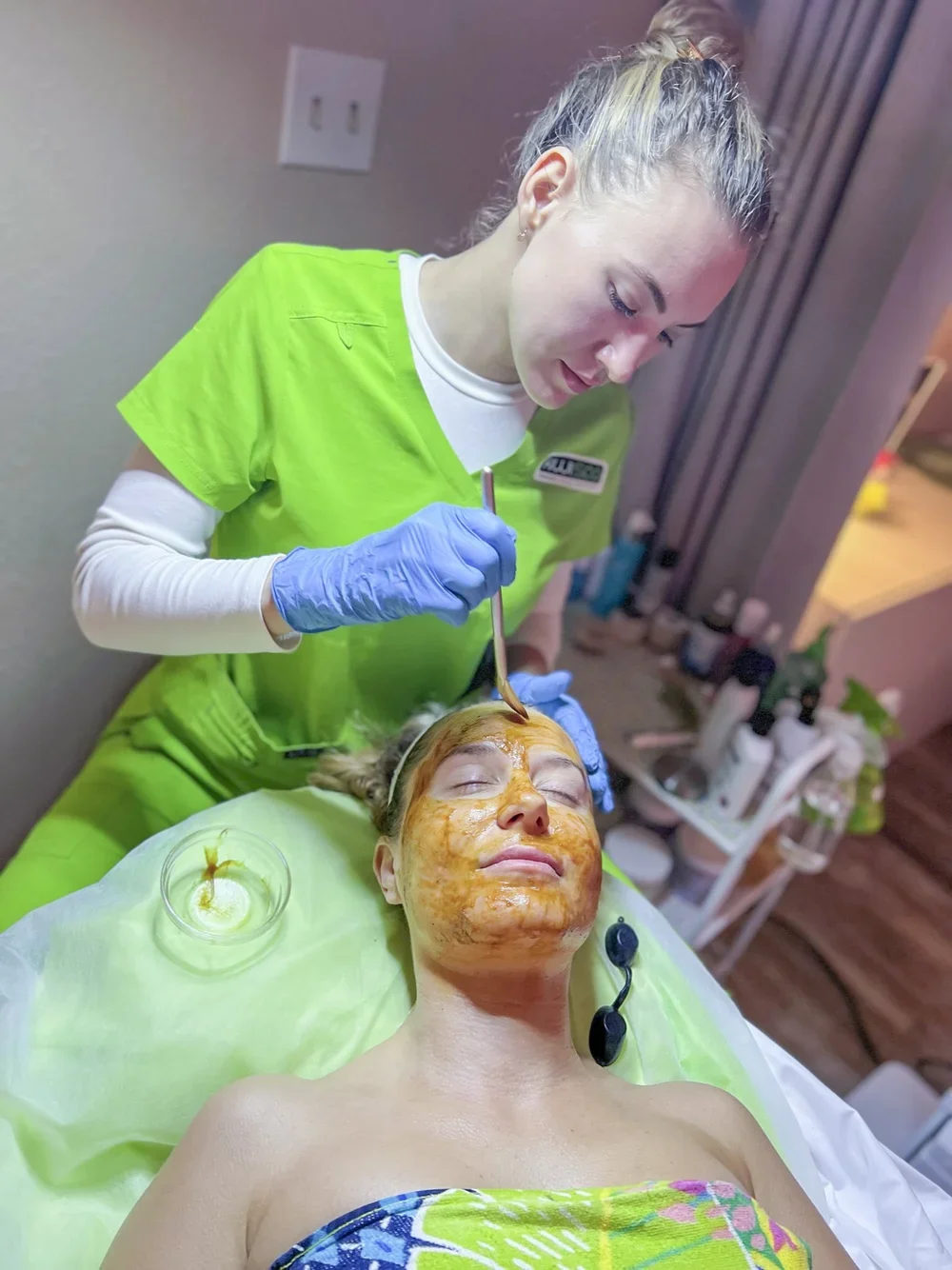 What Are Chemical Peels and How Do They Help with Pigmentation?