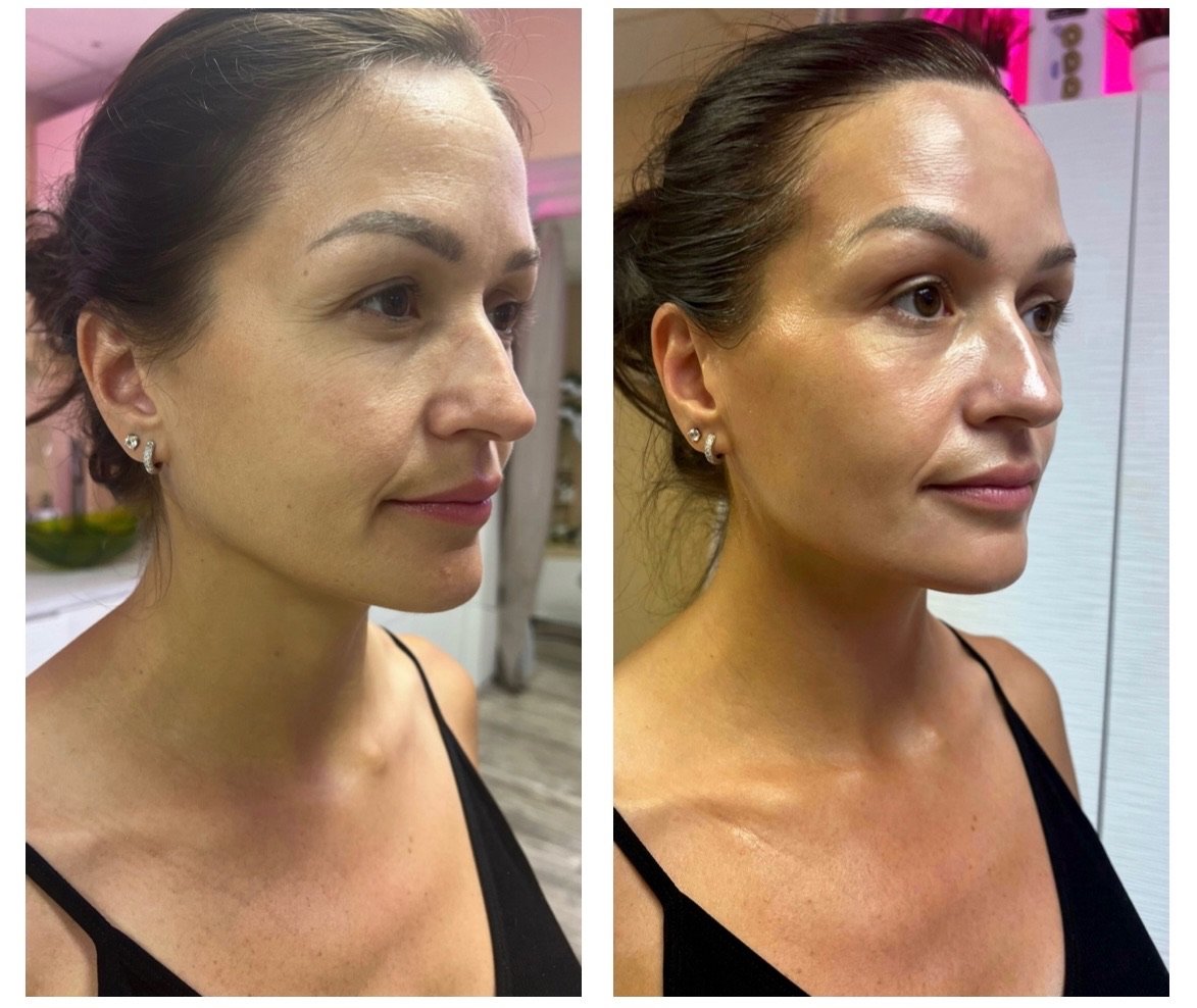 Why a Custom Facial Is One of the Best Things You Can Do for Your Skin in San Diego