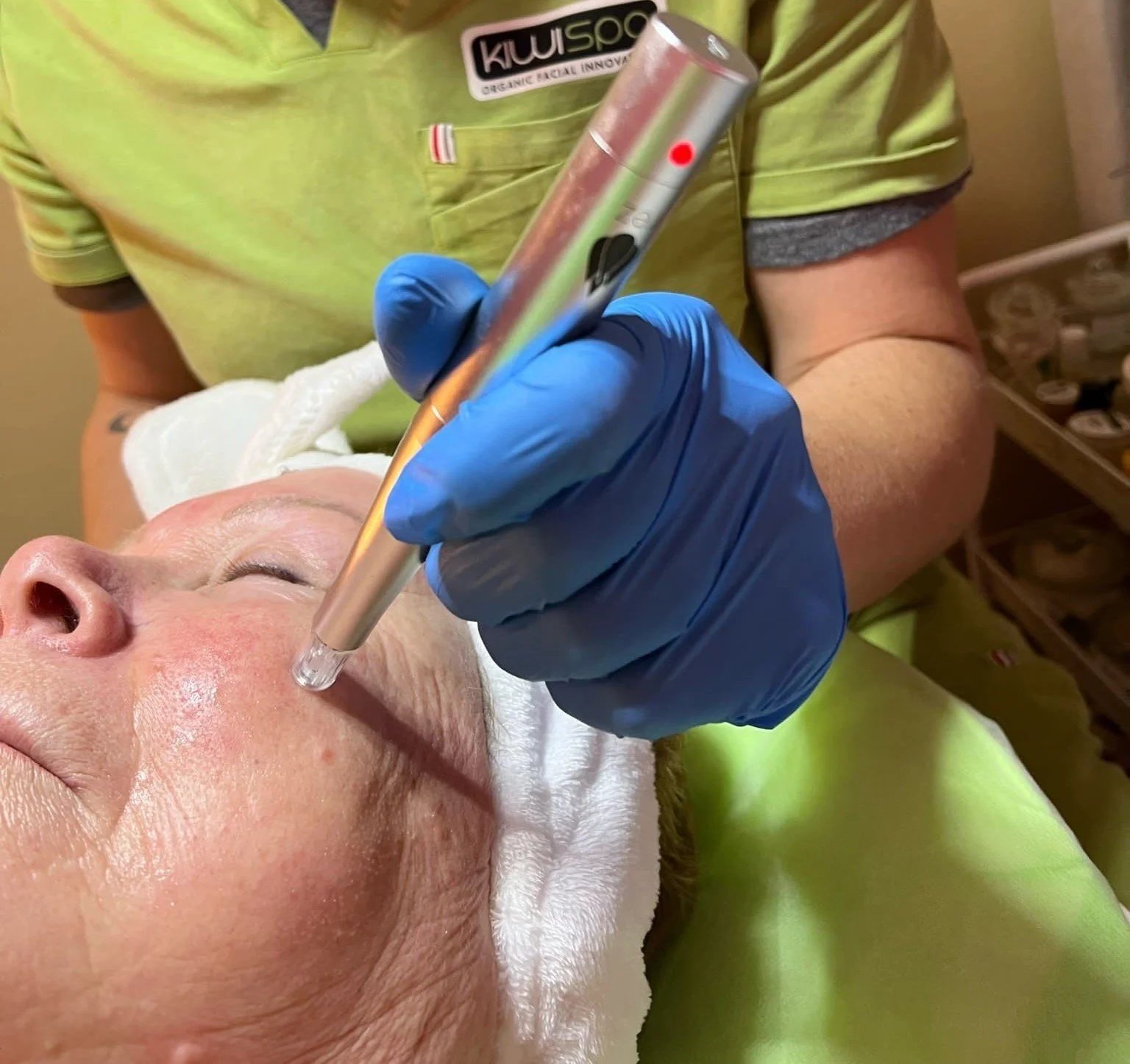 What Causes Fine Lines and How Nanochanneling Helps Smooth Your Skin