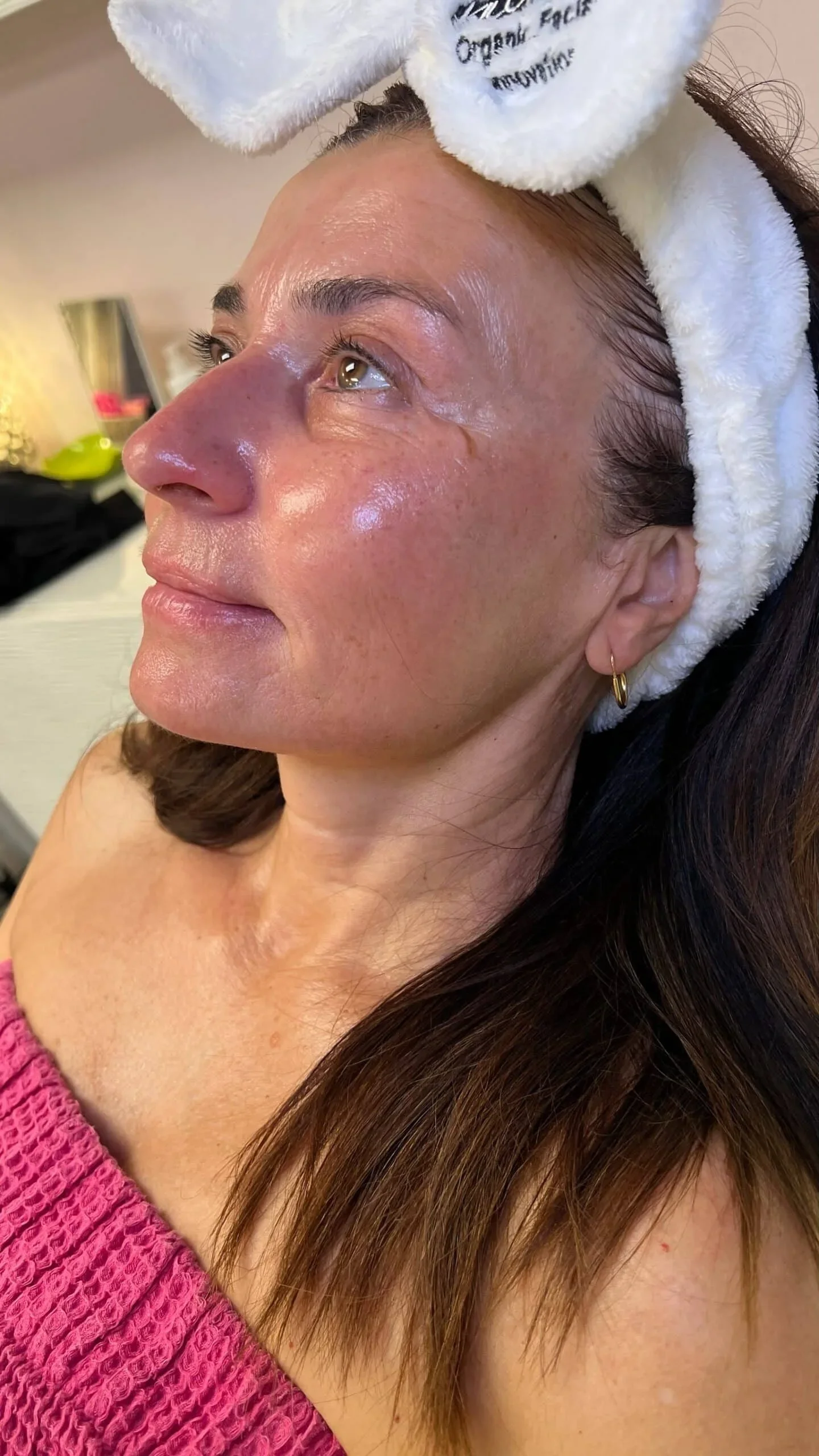 What Are the Benefits of a Custom Facial in San Diego?