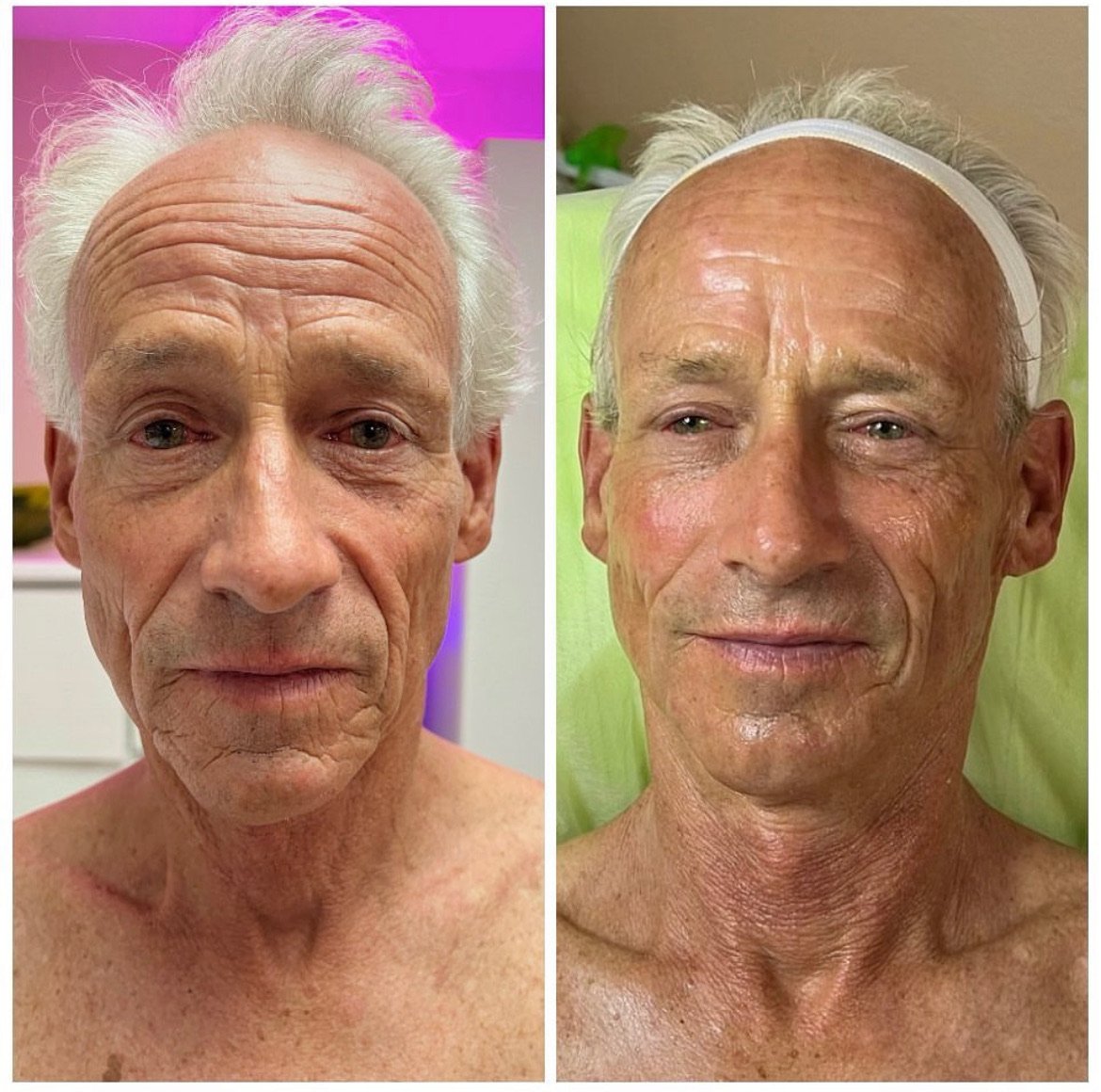 Men’s Facial San Diego: Professional Skincare for Healthy, Refreshed Skin