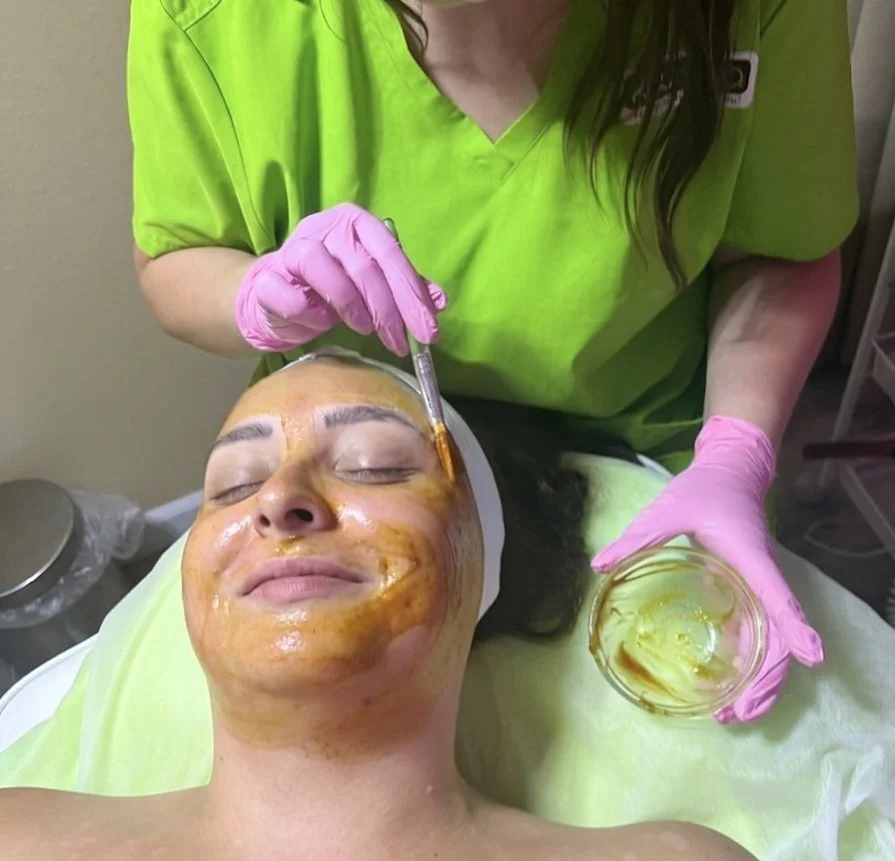 Chemical Peels in San Diego: What Are the Benefits and Is It Right for Your Skin?