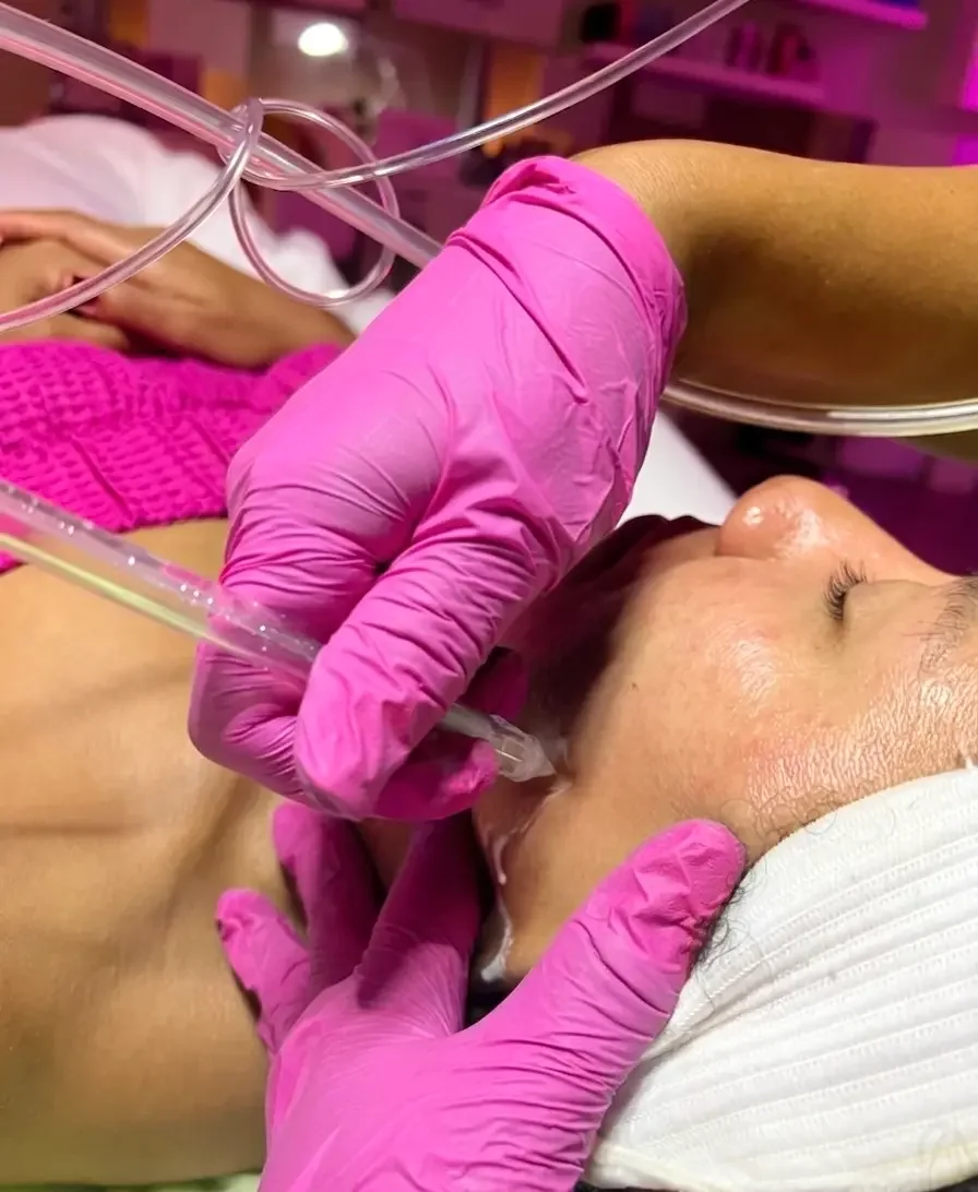 Jet Peel in San Diego: What Are the Benefits of This Unique Facial?