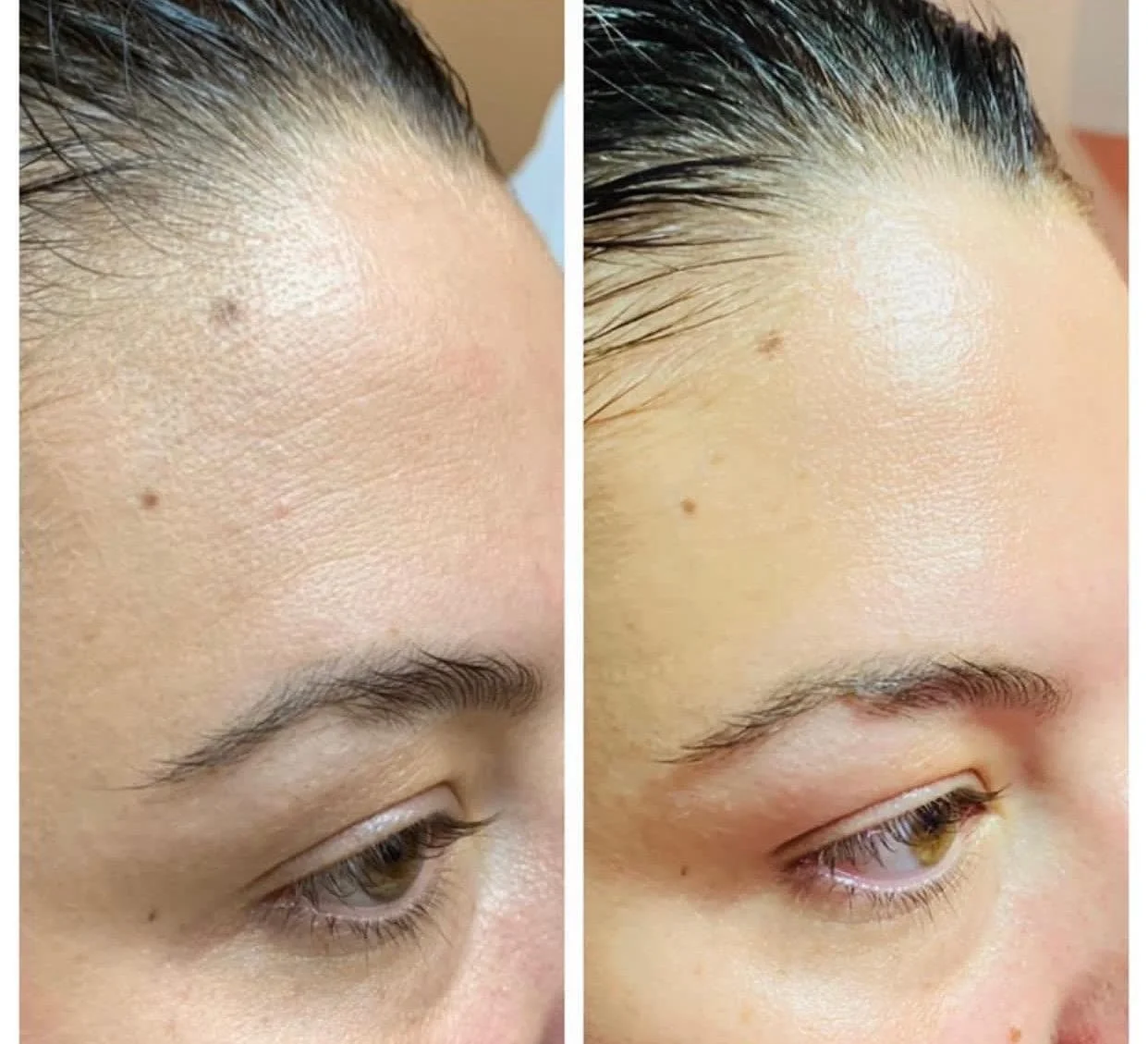Hydrating Facial in San Diego: Why Your Skin May Need More Moisture