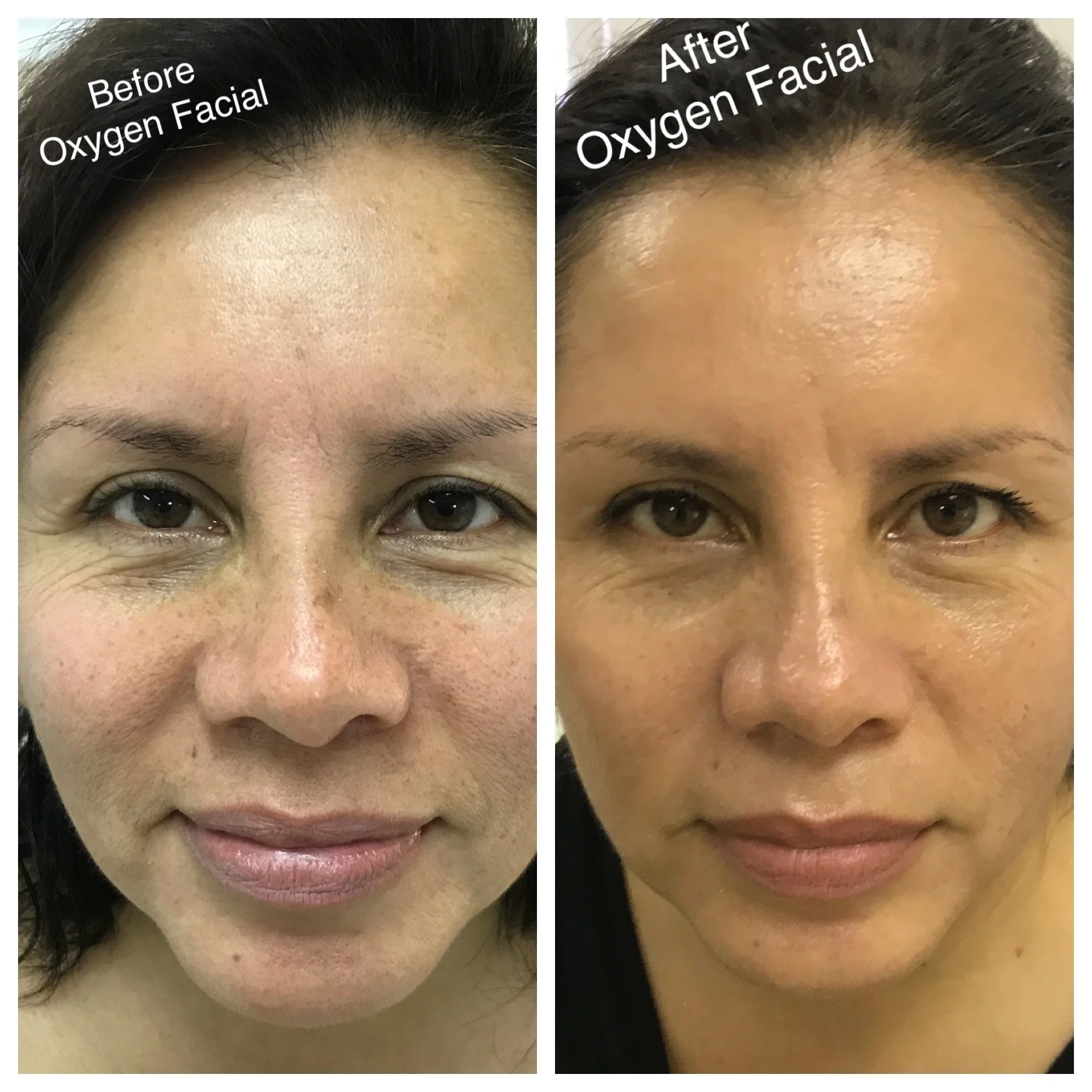 Looking for an Anti-Aging Facial in San Diego? Discover a Glow-Focused Skin Experience at Kiwi Spa