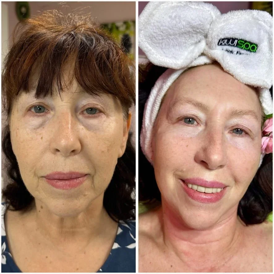 Looking for a Deep Hydration Facial in San Diego? Restore Your Glow at Kiwi Spa