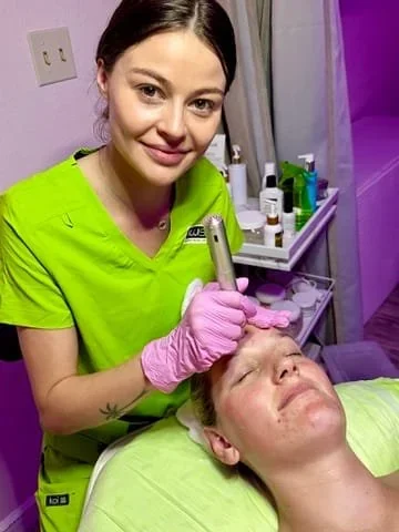 Nanochanneling Facial San Diego: A Luxury Skincare Experience for Smoother, Radiant Skin at Kiwi Spa