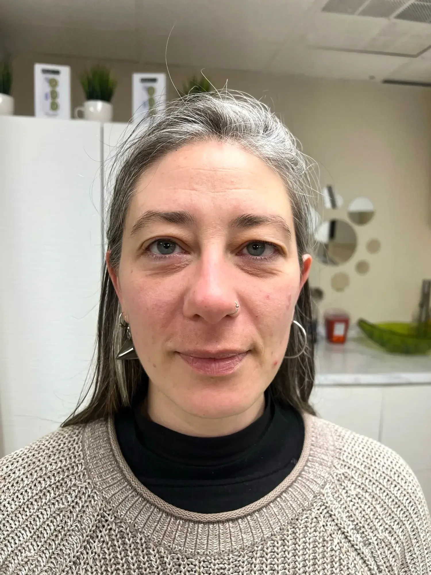 Transformation Journey Before