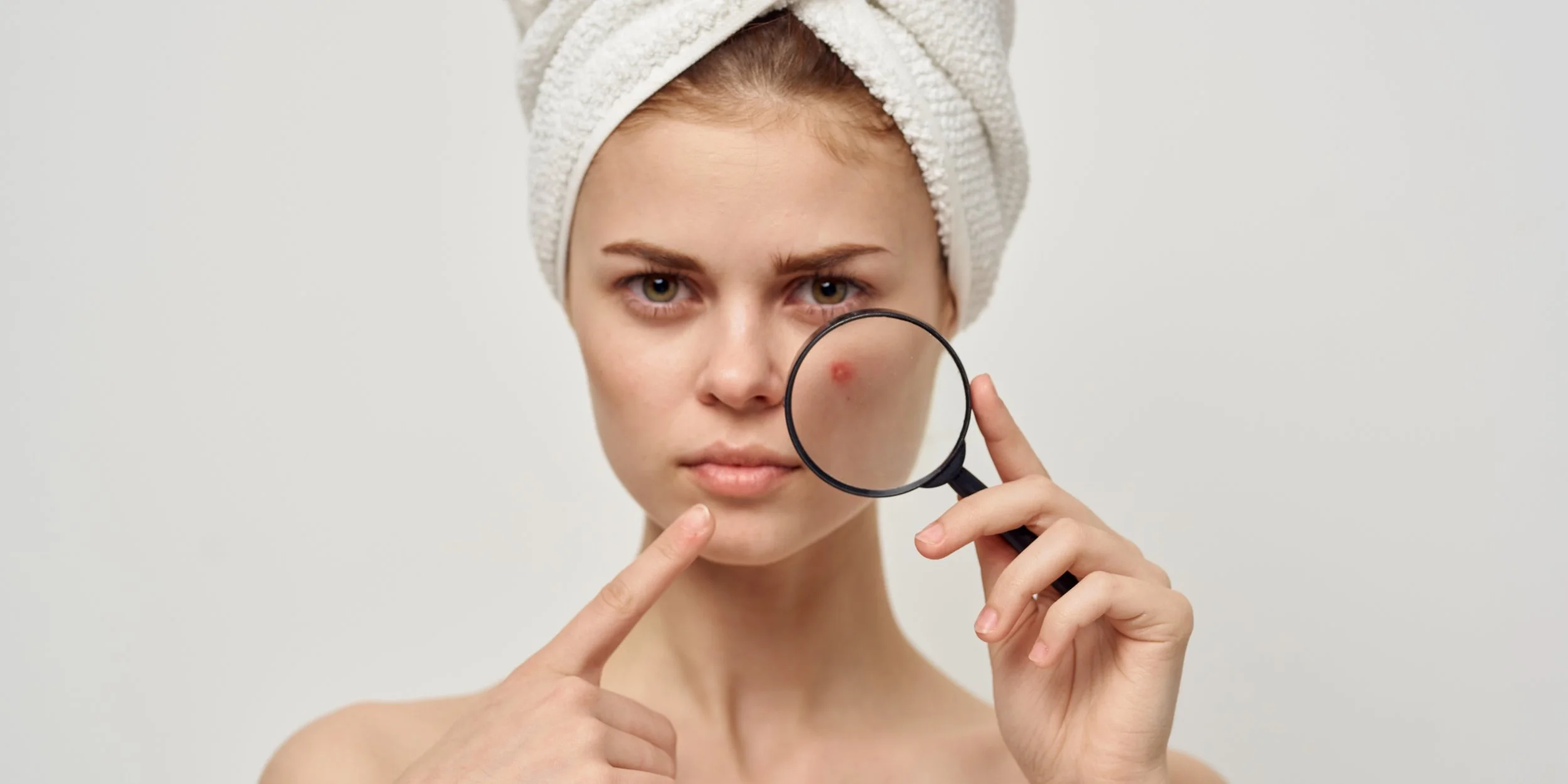 best acne facial san diego