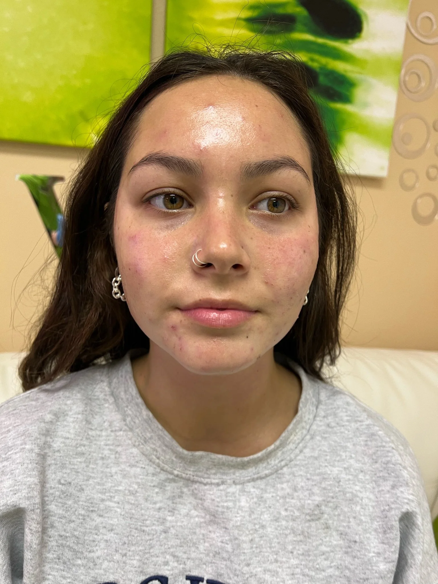 Transformation journey gallery before