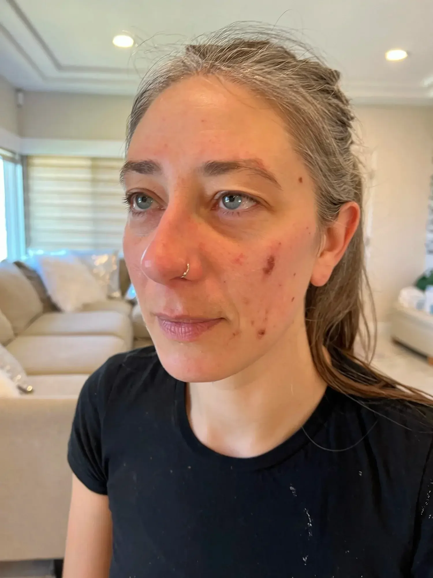 Transformation journey healing progress