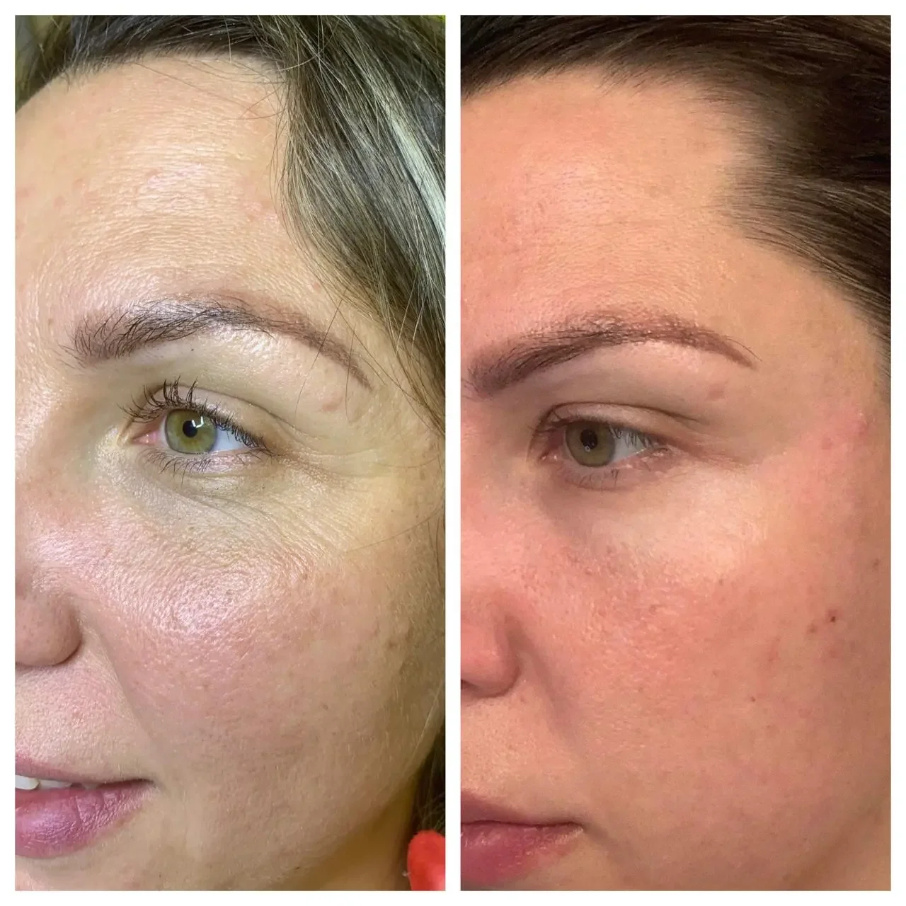 Anti-aging Facial in Pacific Beach