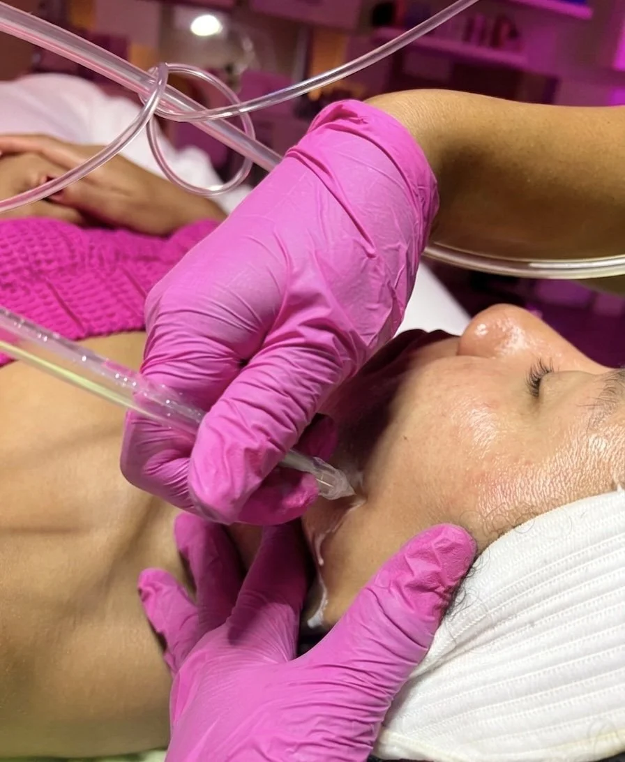 JetPeel oxygen infusion San Diego
