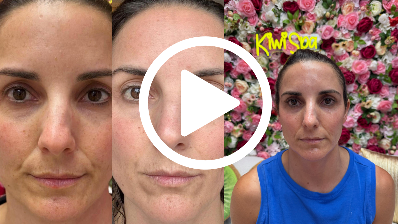 Human Placenta Facial San Diego