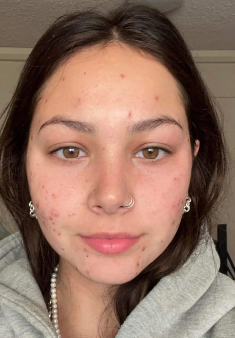 Transformation journey gallery healing progress