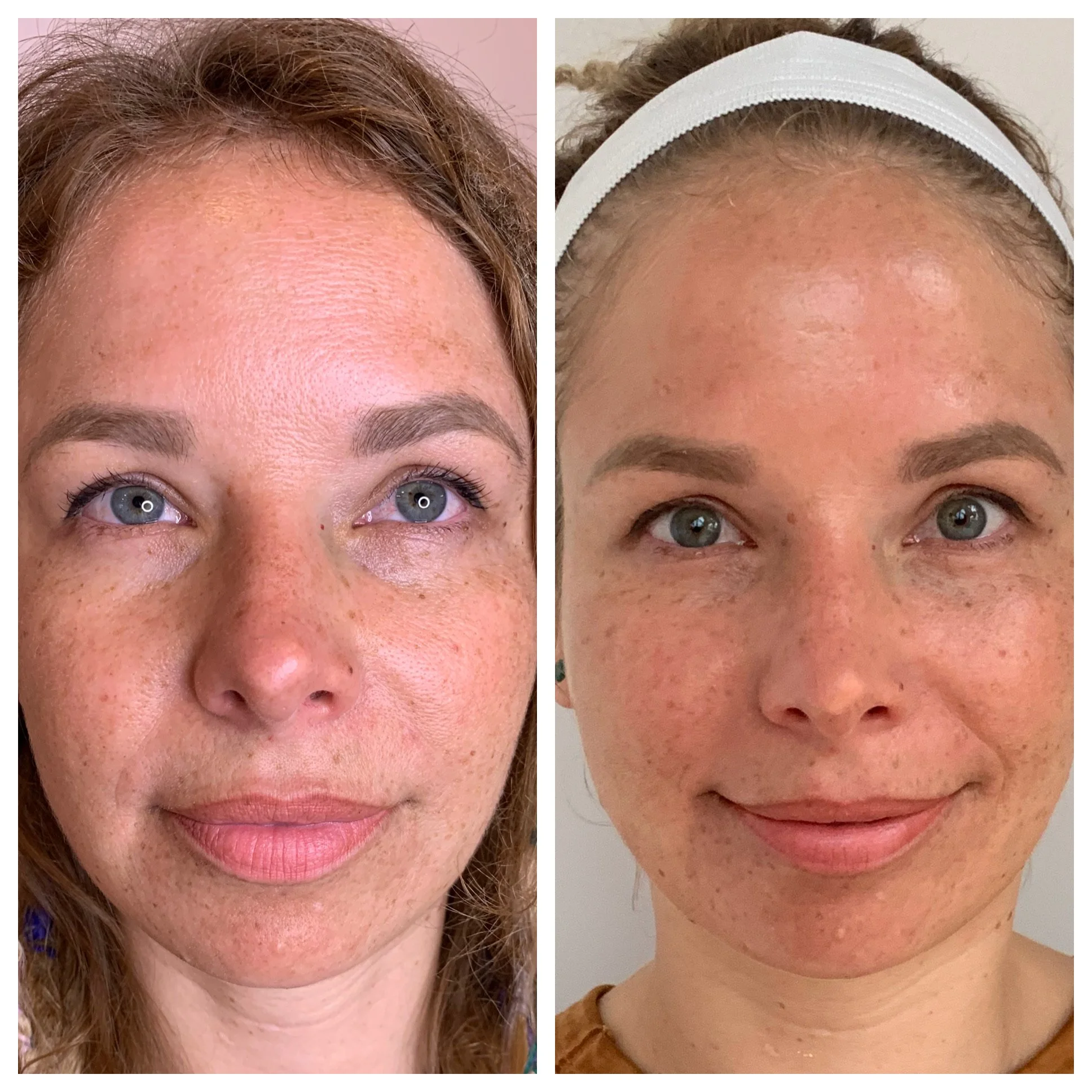 Holistic facial treatment