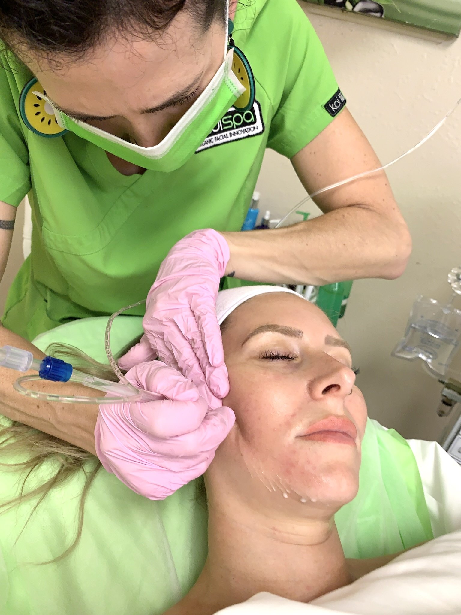 jetpeel facial san diego