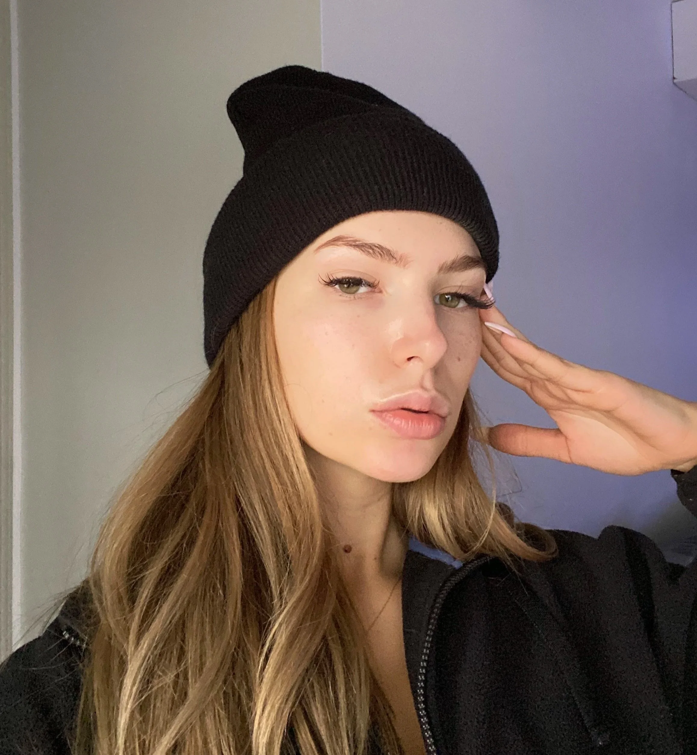 Makeup-free portrait showing clear skin prior to inflammatory acne.