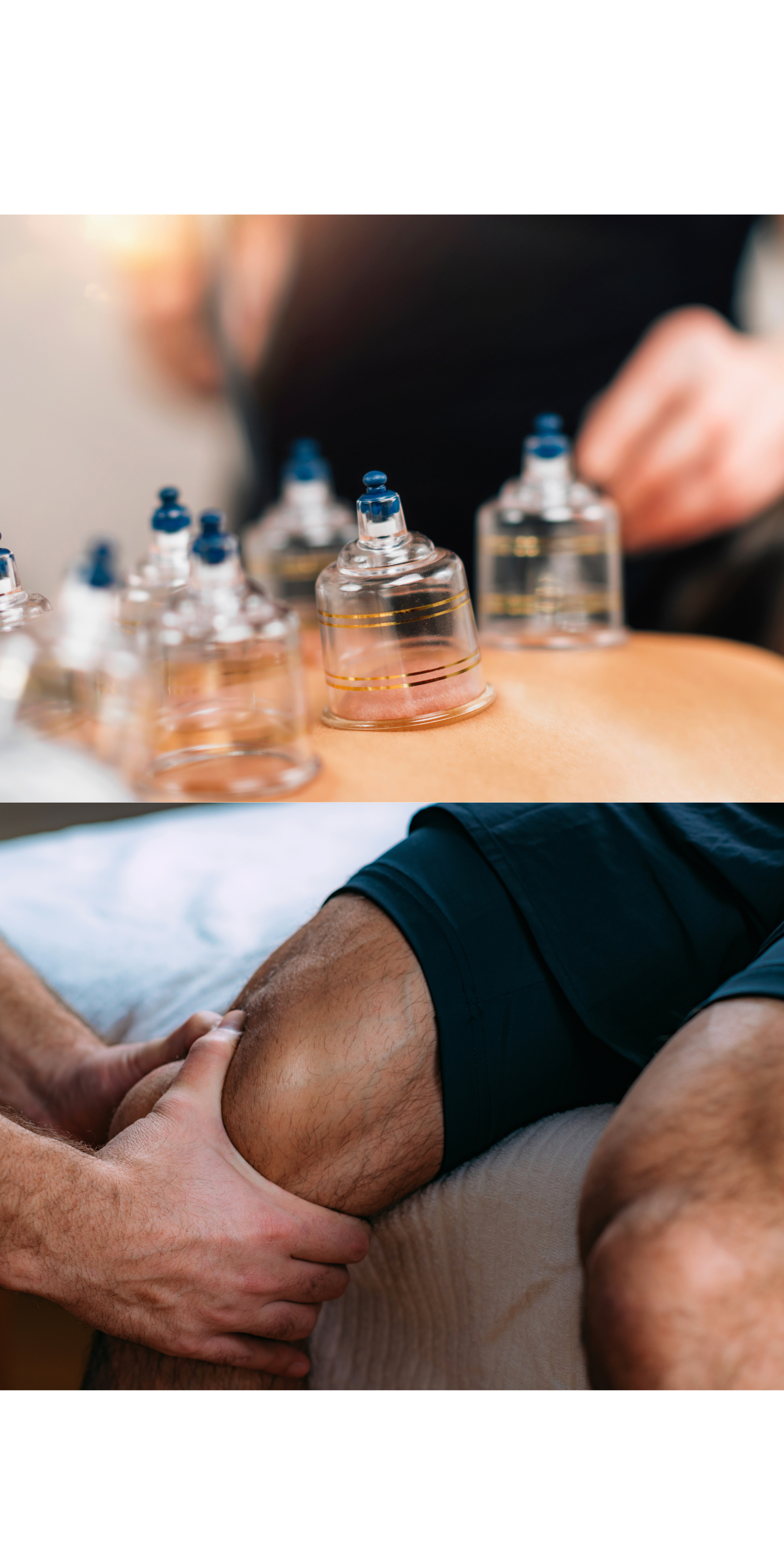 A person getting cupping therapy on their back, with several glass cups placed on their skin, and a practitioner performing the treatment.