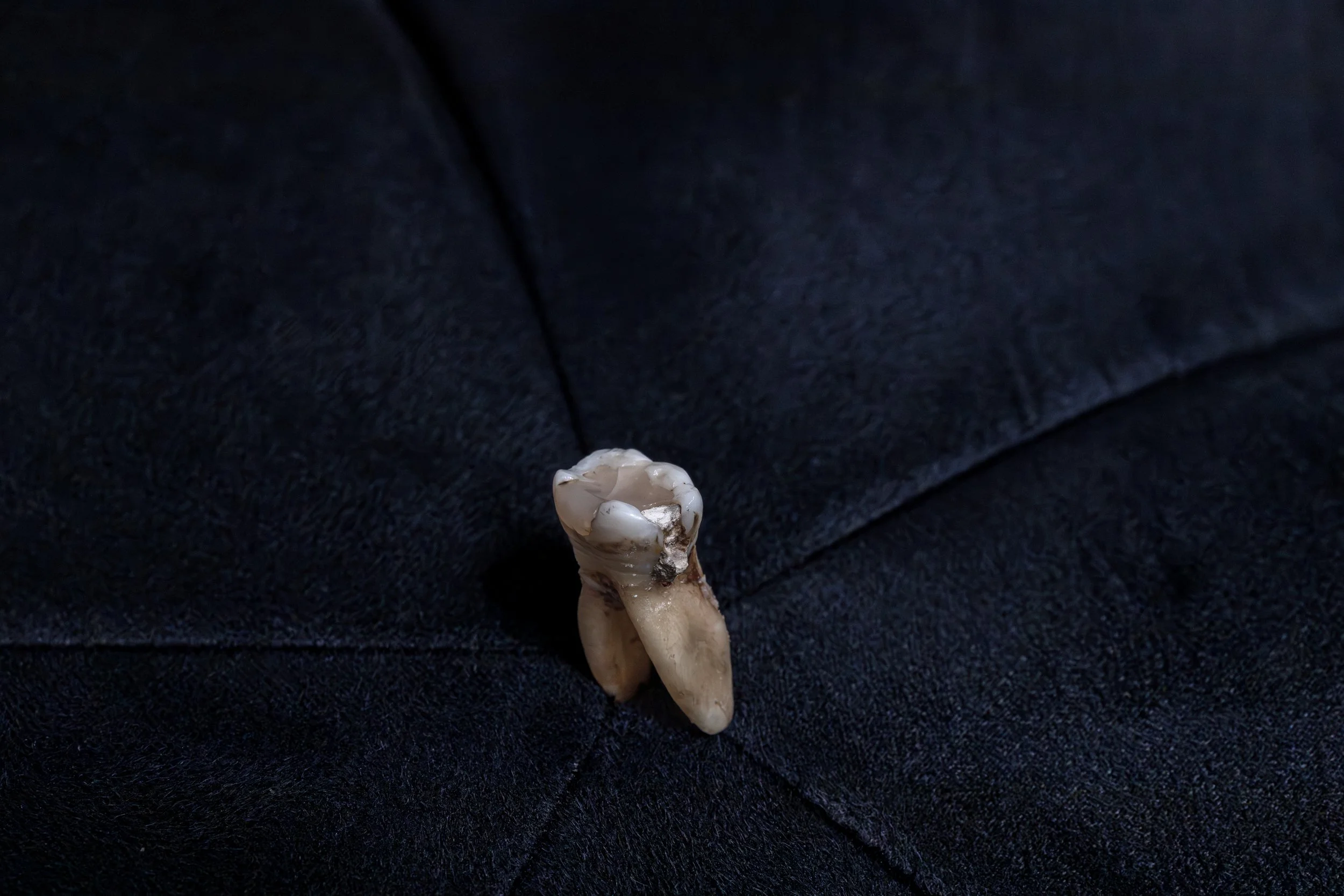 Tooth 30_120925.jpeg