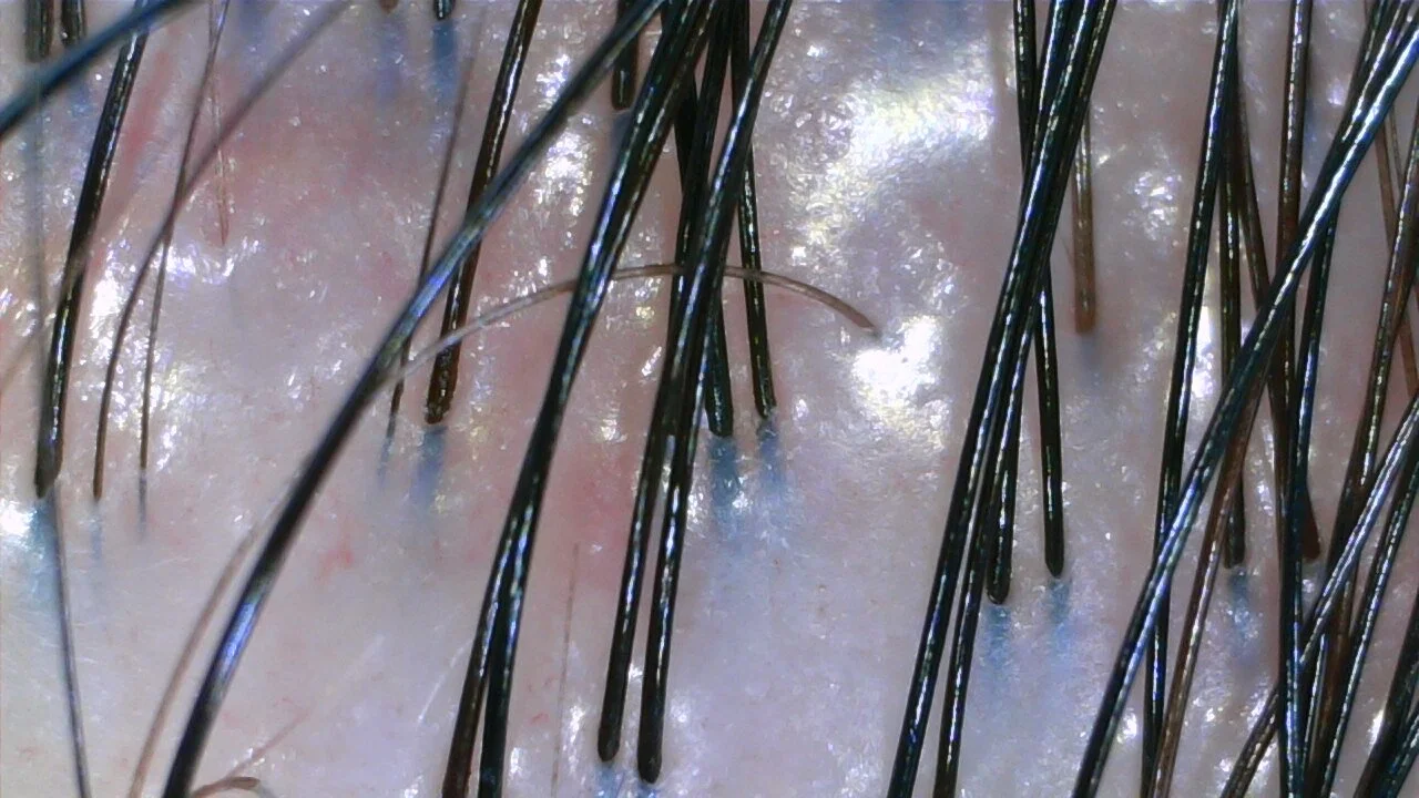 What Your Scalp Might Be Telling You About Your Health